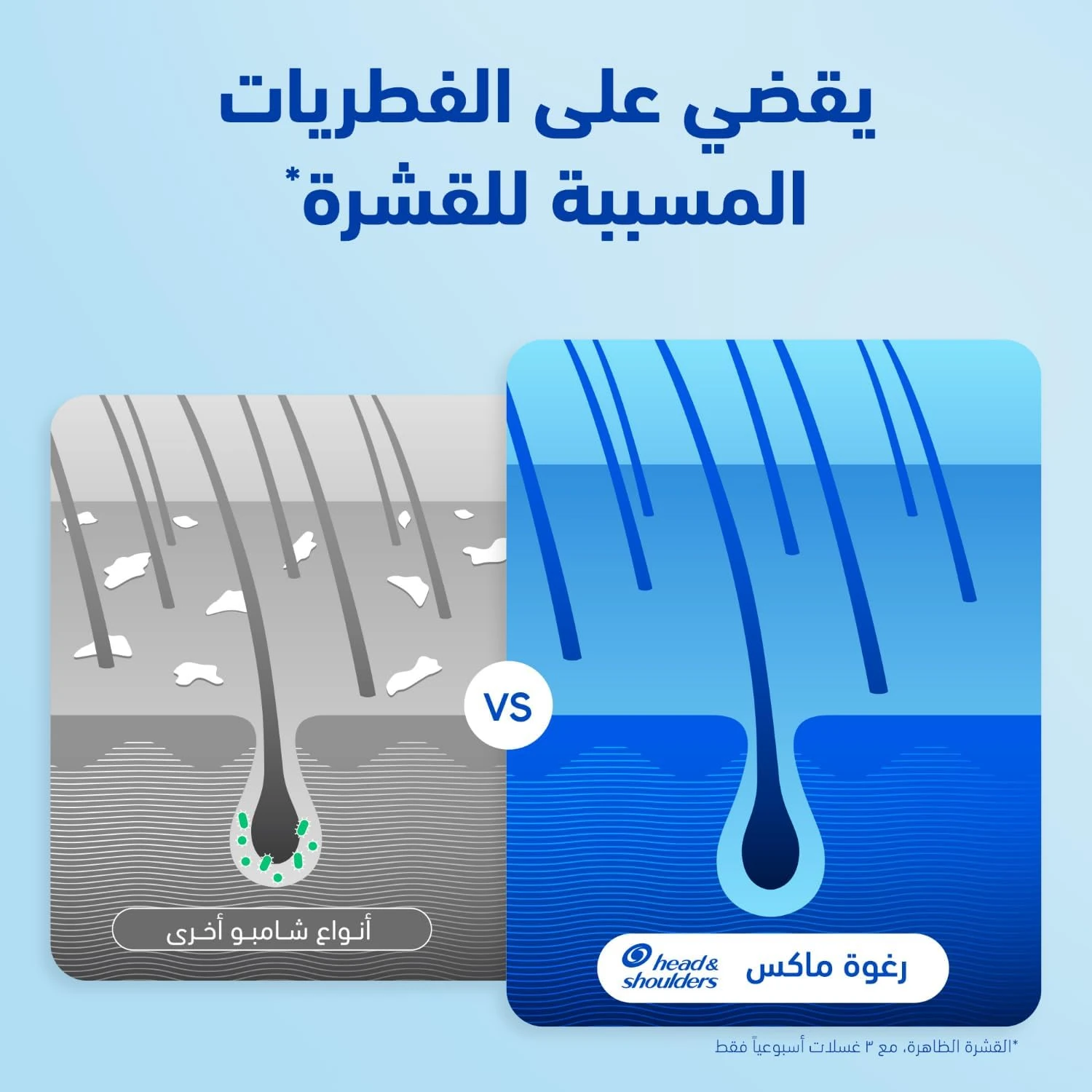 شامبو هيد اند شولدرز ضد القشرة بالنعناع 390 مل